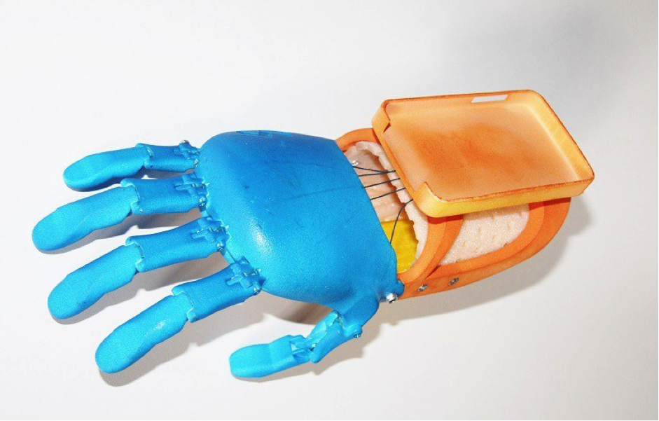 A 3D-printed prosthesis for children with wrist injuries is already available on state health, thanks to Motorica (Photo: Motorica)
