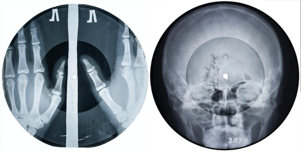 X-ray records. Image courtesy Stephen Coates/The X-Ray Audio Project