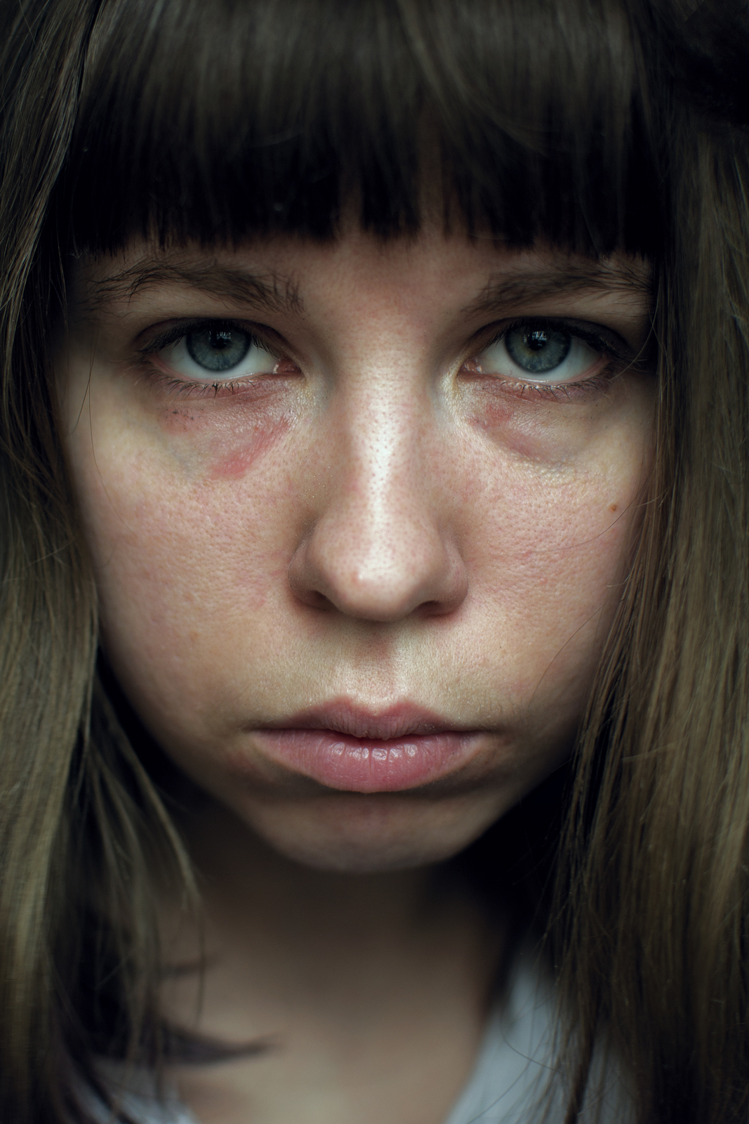 Self-portrait with Allergic Spots. From the me(a)ss project, 2017-2020