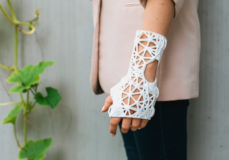 These delicate 3D-printed casts from Latvia could be the future of personalised healthcare